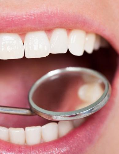 Mouth examined with dental mirror