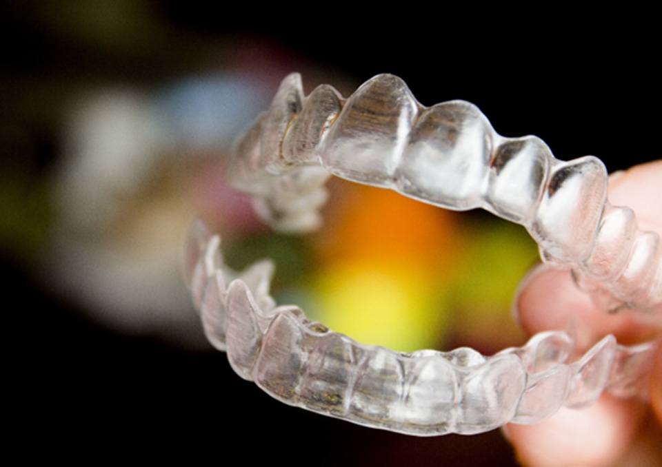 Invisalign aligners in Richardson  