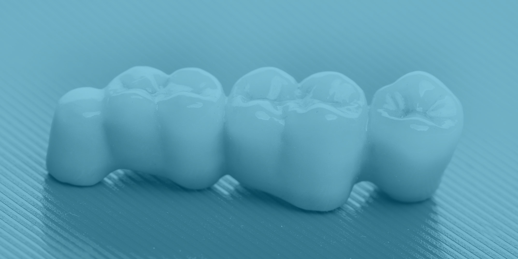 Dental Bridges Richardson | Close Gaps | Cityline Dental Center