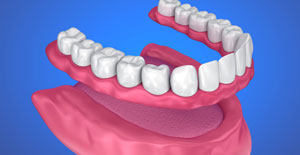 Animated smile with full denture