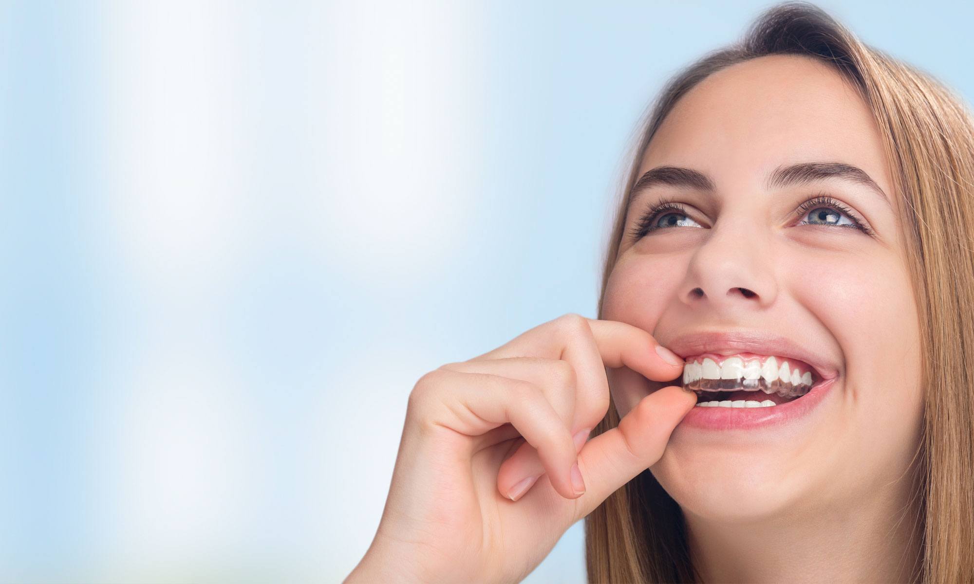 Woman placing an Invisalign tray