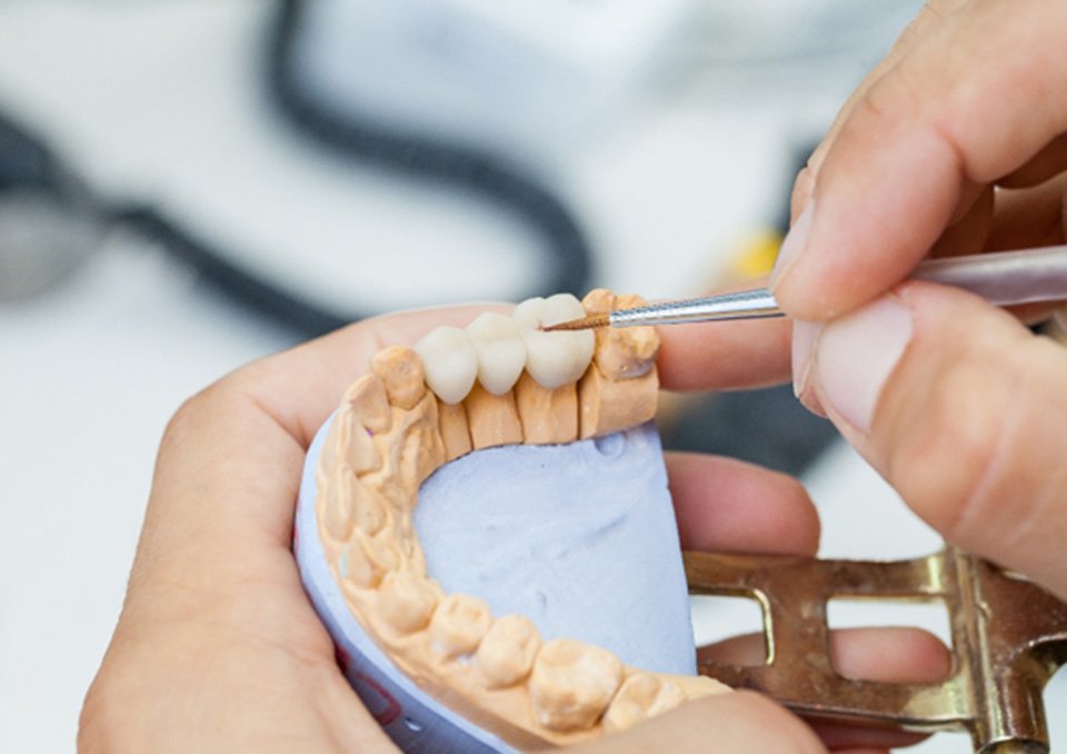 dentist working on dental bridge