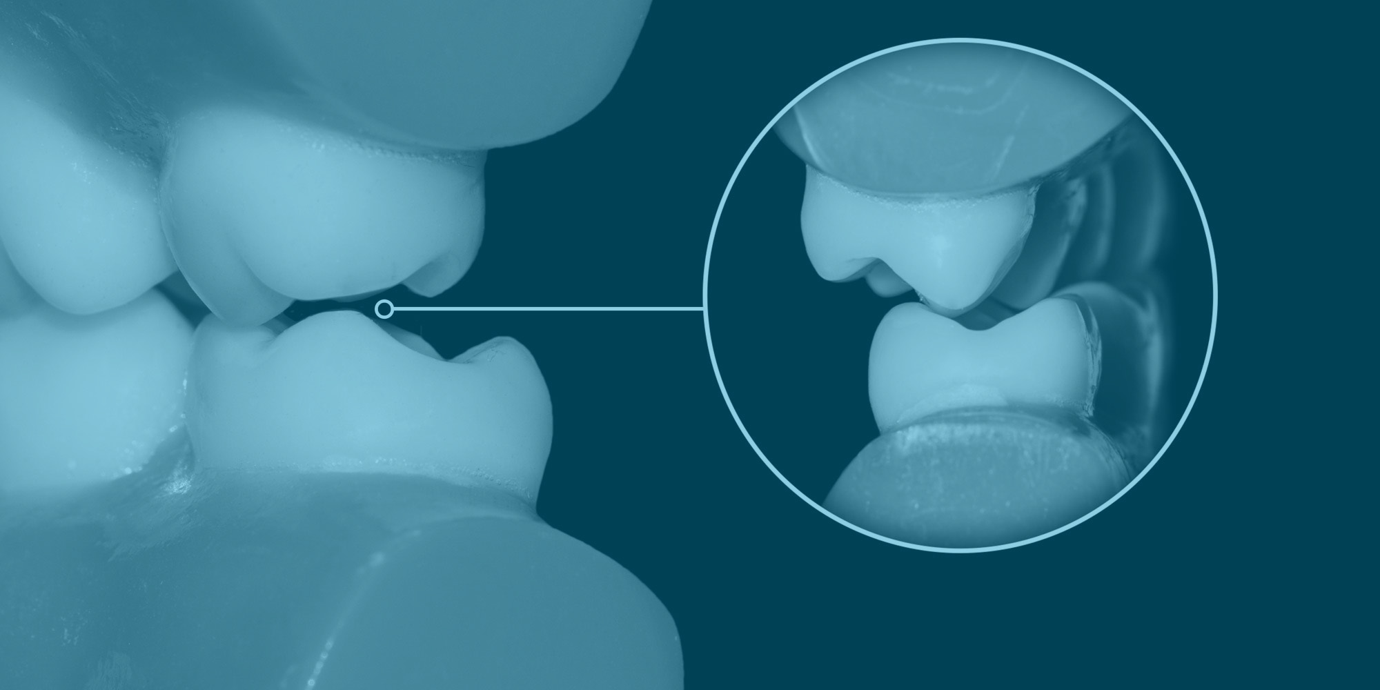 Closeup of teeth grinding