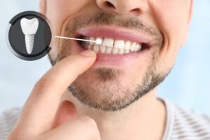 Man checking his dental implant