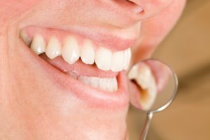 dentist in richardson recommends regular hygiene appointments