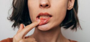 Woman with inflamed gums